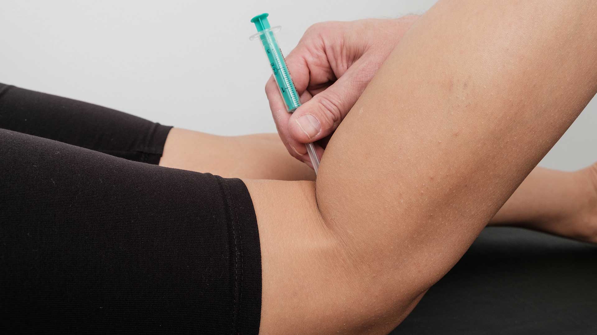 Lokalna blokada boli mišića Lokalna-blokada-boli-misica